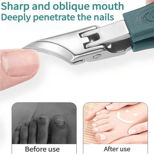 🔥Last Day Sale 49% OFF - 💅Eagle Beak Angled Nail Clippers 3-Piece Set